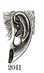 overall view of ear trumpet