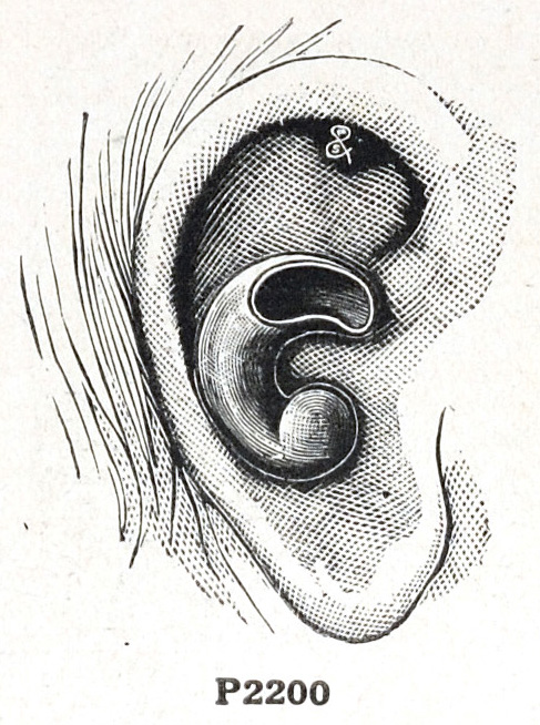 overall view of ear trumpet