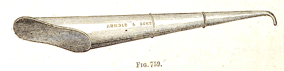 overall view of ear trumpet