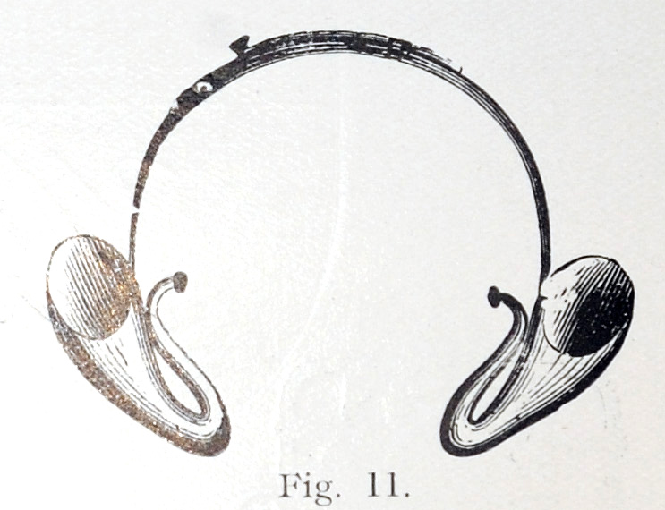 overall view of ear trumpet
