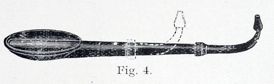 overall view of ear trumpet