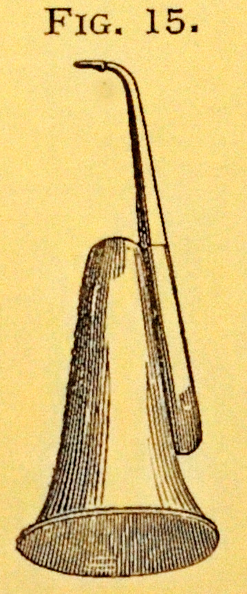 overall view of ear trumpet