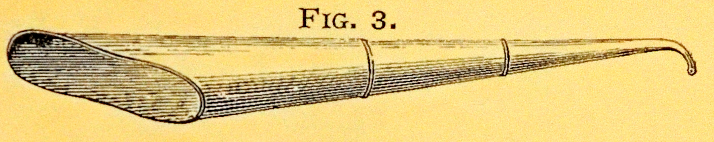 overall view of ear trumpet