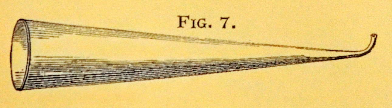 overall view of ear trumpet