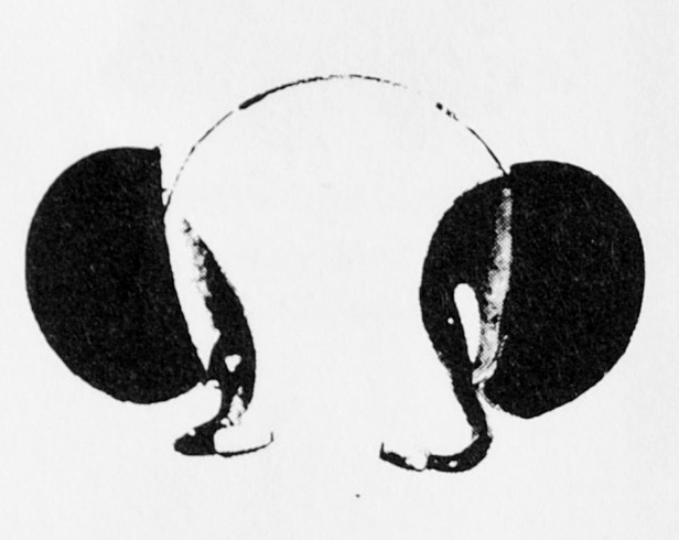 overall view of ear trumpet