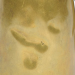 detail view of ear trumpet
